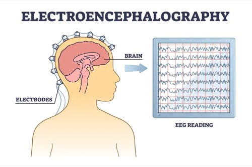 Electroencephalography (EEG) in Nagpur
