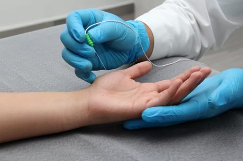 Electromyography (EMG) patient hand taking sample through needle