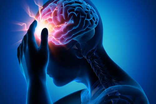 Migraine head pain 3d blueprint