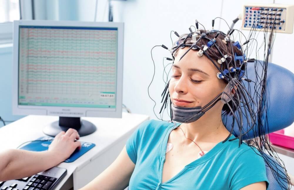Electroencephalography