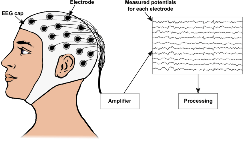 Electroencephalography