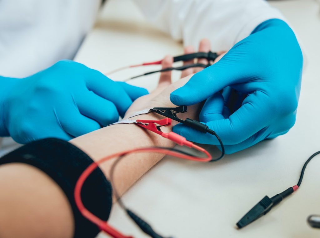 How Electromyography
