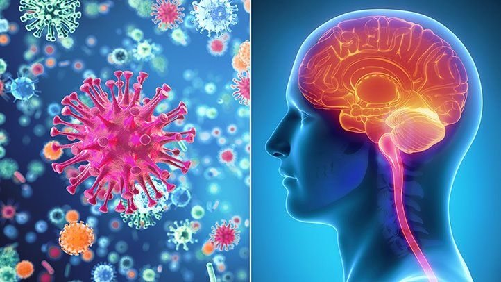 Meningitis