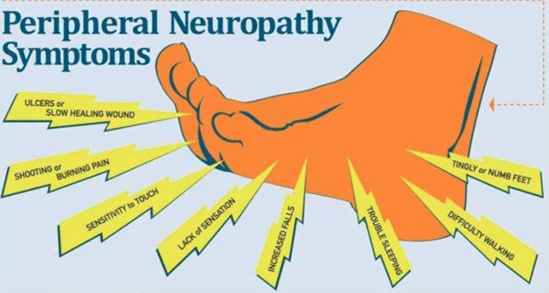 Neuropathy